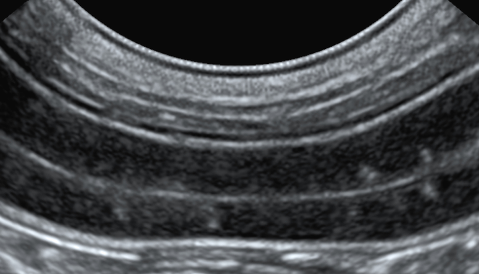 Intensive Ultrasound Short Course